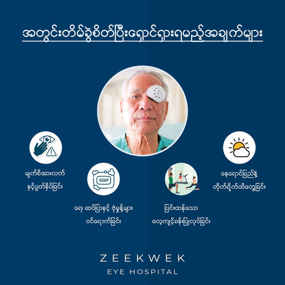 မျက်စိအတွင်းတိမ်ခွဲစိတ်ပြီး ရှောင်ရှားရမည့်အချက်များ